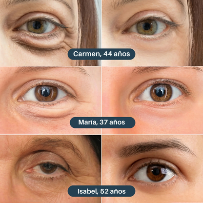 Parches Antiojeras de Nueva Generación