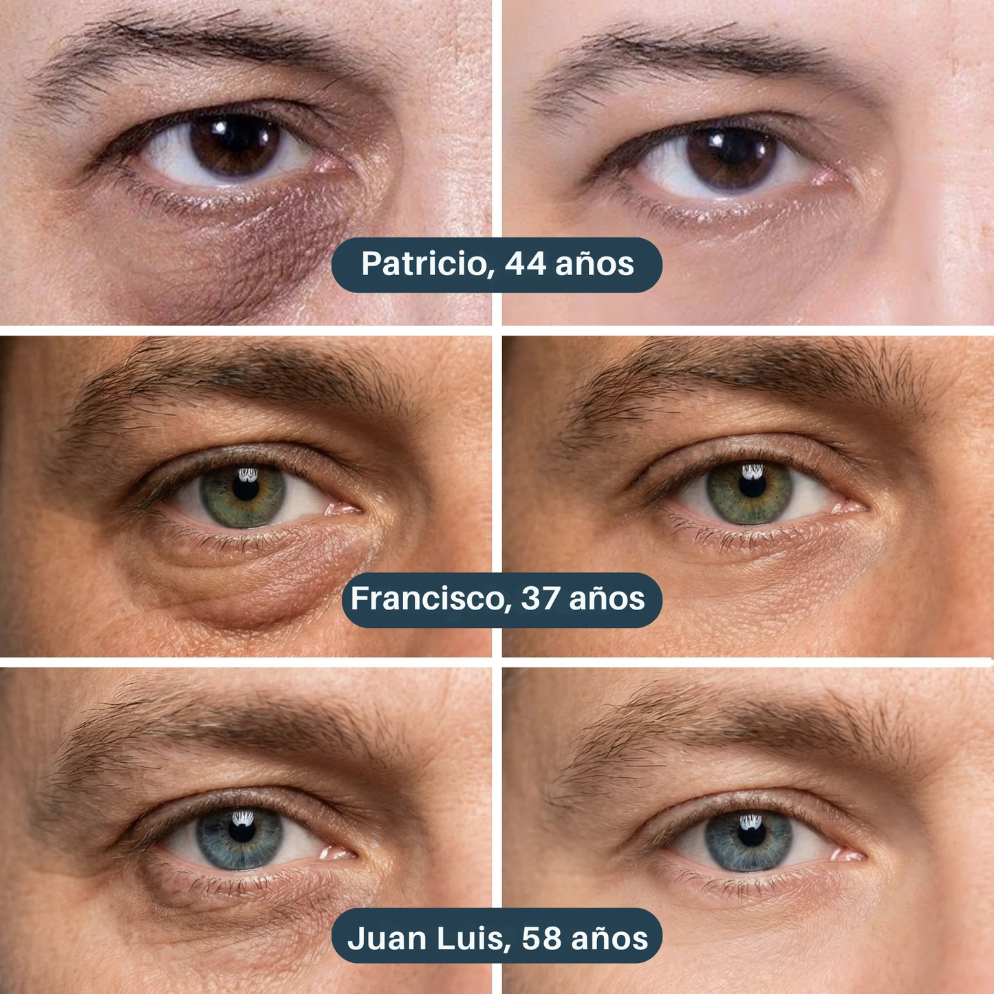 Parches Antiojeras de Nueva Generación